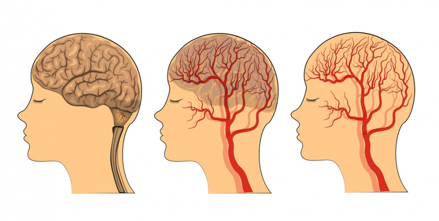 blood flow to the brain