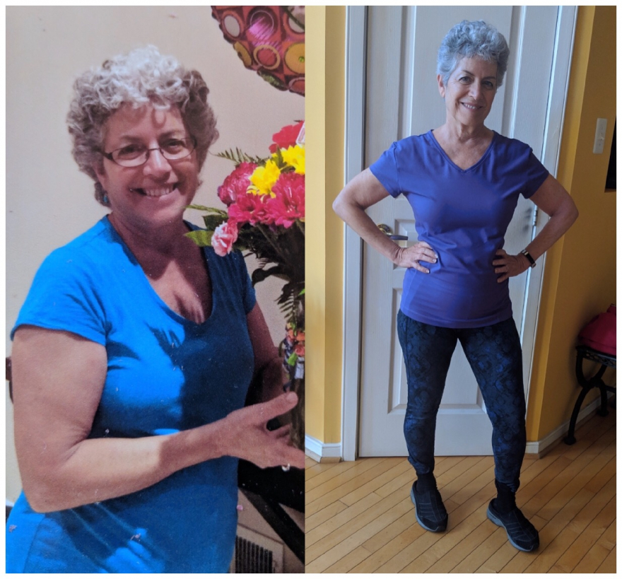 sexy over 60 before and after picture